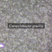 Campylobacter gracilis