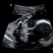 임신7개월, 24주 5일 태아 초음파/ 임당 검사 및 결과/ 태동기록