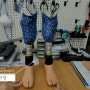 양쪽 하퇴의족 제작과정부터 의족보행까지 : 양쪽 다리절단 후 의족