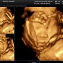 [baby] 임신 23~24주 일기🌸🌼🌷🌻 (임당검사, 정밀초음파)
