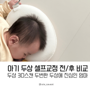아기 두상 셀프교정 단두 사두 수치 비교 니노필로우 3개월 사용 후기