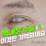 [백내장 수술 약수역 소망안과] 백내장 수술 방법, 인공수정체 선택, 수술 후 주의사항