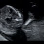 두번째 임신일기, 12주 입체초음파 성별이 궁금해요