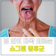 입 안이 바싹 마르는 ‘쇼그렌 증후군’ … 구강건조 예방법은?