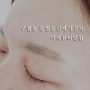 구월동 눈썹문신제거 2차 후기_미작뷰티인천