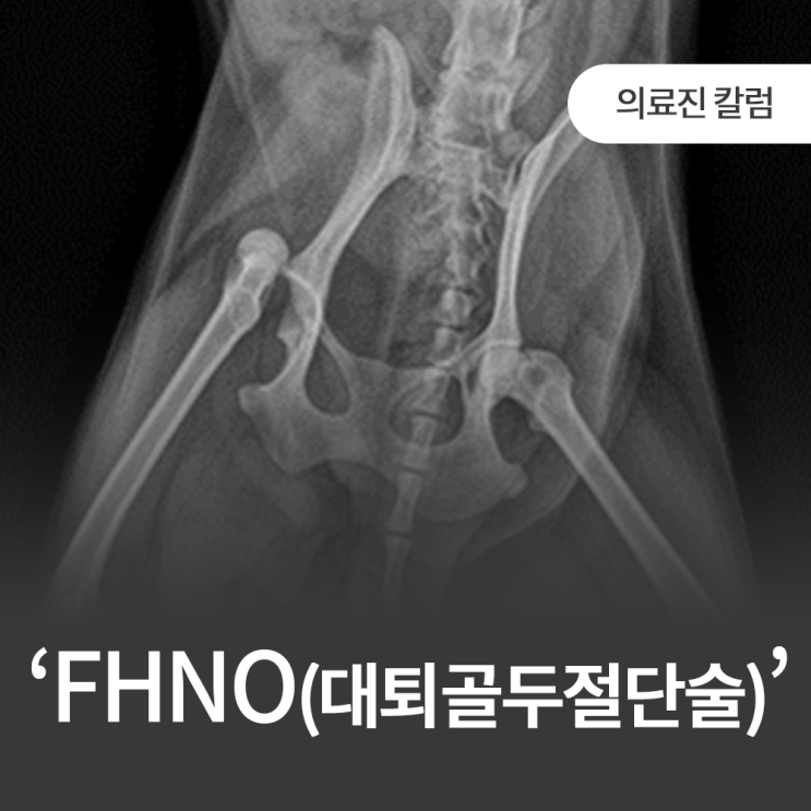 탑케어 특화수술 [TOP3] : 대퇴골두절단술(FHNO) : 네이버 블로그