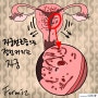 자궁선근증 미레나 호르몬 치료의 마지노선