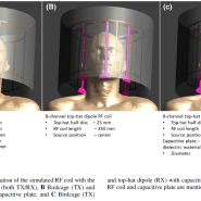 [의료기기설계 SW] Sim4Life 해석사례 : MRI 디자인 - 고려대