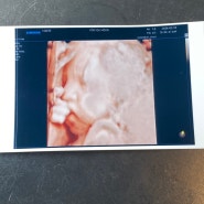 임신 27주 차 증상 : 입체 초음파