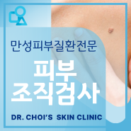 부천 맑은석피부과 정확한 진단을 위한 피부 조직검사