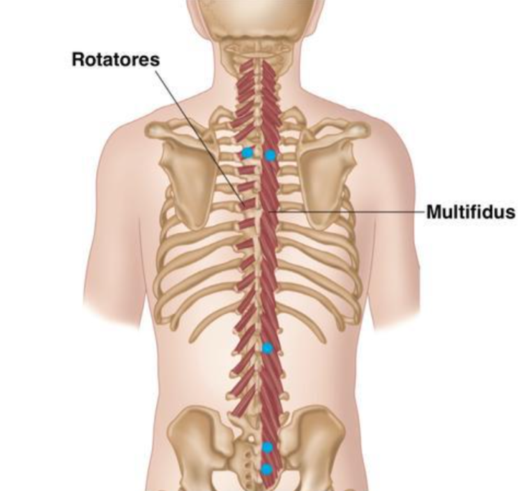다열근(Multifidus)의 기능과 역할, 척추 안정성(Spine stabilization)을 위한 핵심적인 운동 : 네이버 블로그