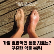 통풍 주사로 통증 완화하기 [덕천 류마본내과의원]