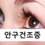 안구건조증 증상 심할 때 치료 인공눈물 점안액 사용방법