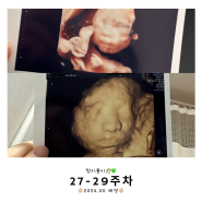 쌍둥이 27-29주 입체초음파, 자궁수축(배뭉침)으로 병원 입원, 자궁경부길이 1.5cm, 출산휴가 육아휴직 신청