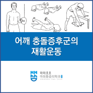 수완지구/광산구 정형외과 어깨 충돌증후군의 재활운동