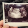 [임신5주]진해진 임테기두줄,임신초기 산부인과 가는시기, 아기집보고 임신 확인서 발급