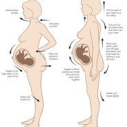 임산부 허리 통증 운동법