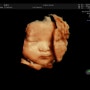 [임신 34주차] 이대서울병원 정기검진 입체 초음파 성공기