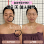 광화문 피부관리 올리즈에스테틱 윤곽관리후기 작은얼굴 직각어깨관리 추천