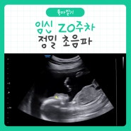 [육아일기] 임산부 20주차 정밀 초음파 촬영!