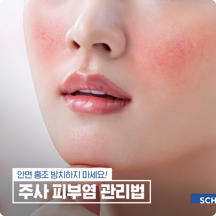 주사 피부염 염증 치료 및 관리법 : 네이버 블로그
