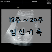[13주~20주 임신기록] 안정기 / 임밍아웃 / 성별 확인 / 2차 기형아검사 / 씬지로이드 복용 / 삼성카드 베이비키트