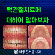 수원 턱관절치료에 대하여 알아보자