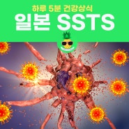 일본 SSTS 연쇄구균독성쇼크증후군 원인, 증상, 진단, 치료, 예방법