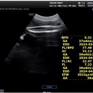 [임신일기] 임신막달 38주~39주 2일