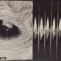 [임신 7주차] 임신초기 산전검사, 초음파