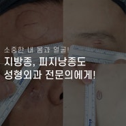 부산지방종 흉 걱정없이 말끔하게