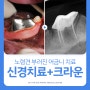 [부산 강아지 치과] 강아지 치아파절 PM4 어금니 신경치료, 크라운 보철 케이스, 양산 24시 동물병원