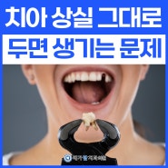 치아 없어도 괜찮을까? 안양 치과에서 알아보기