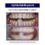경성대치아미백, 누런 내 치아 어떻게 변화할 수 있을까?