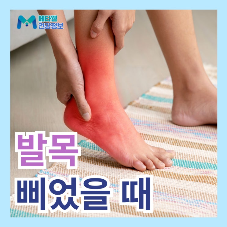 발목삐었을때 병원 발목 접질렀을때 부기 멍 증상 찜질 파스 등 발목염좌 대처법 : 네이버 블로그