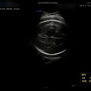 임신 38주 :: 초음파 정기검사 / 드디어 평균체중!