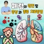 폐렴(pneumonia) 원인과 4가지 종류 폐렴 및 증상 치료방법