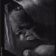 임신 32주 - 일신기독병원 정기검진, 백일해주사, 골반 xray