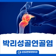 대구무릎수술 박리성골연골염 무릎통증의 원인, 치료법은