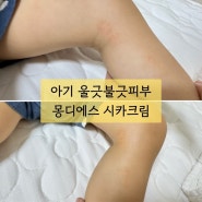 아기침독크림 추천 몽디에스 시카크림 아기얼굴침독