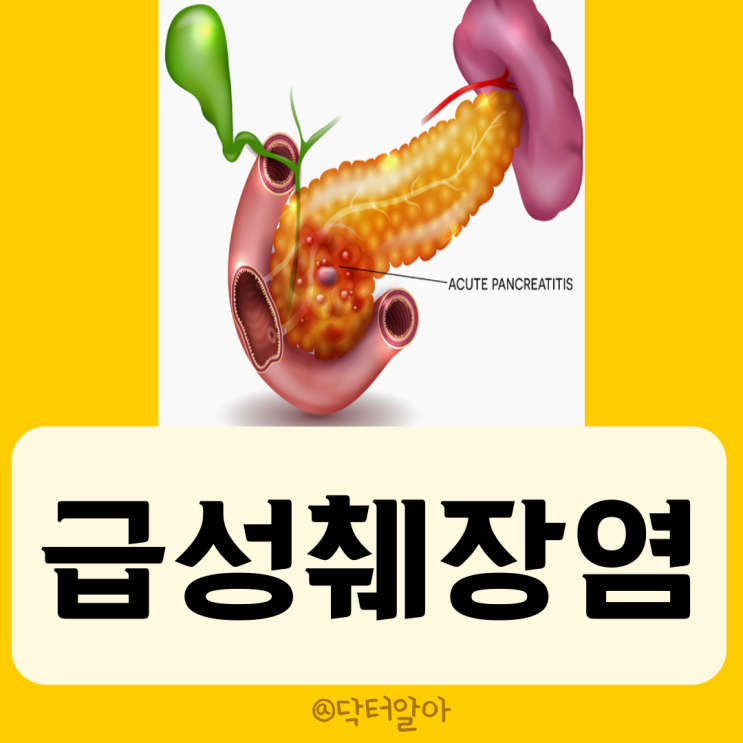 급성 췌장염(Acute pancreatitis)의 정의, 증상, 원인, 진단 및 치료 : 네이버 블로그