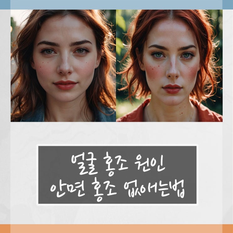 얼굴 홍조 원인 및 안면 홍조 없애는법 : 네이버 블로그