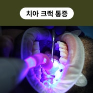 치아 크랙 통증? 원인, 진단 방법, 치료법