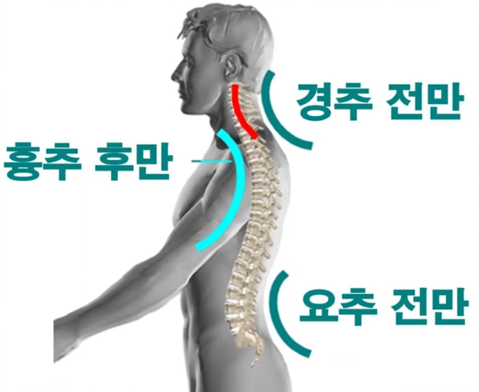요추전만 + 경추신전 : 네이버 블로그