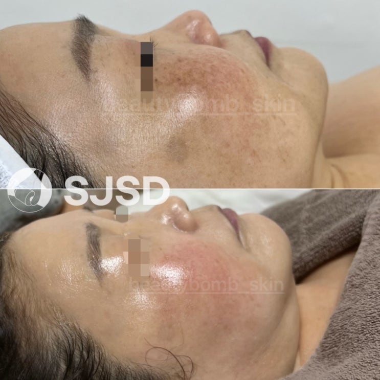 output_2907394042.jpg?type=w2