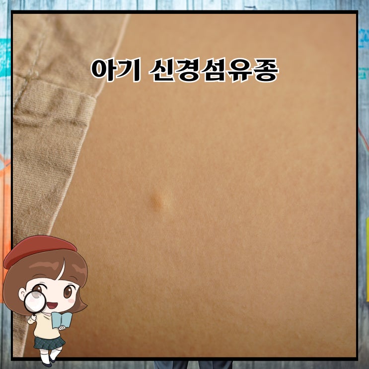 아기 신경섬유종 왜 생기는 걸까요? : 네이버 블로그