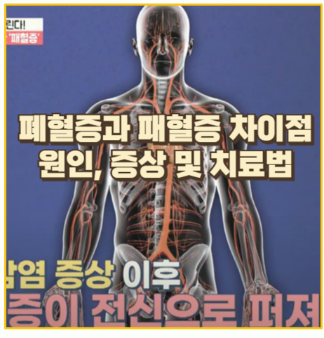 폐혈증과 패혈증 초기 증상부터 예방법까지 경험에서 얻은 생생한 정보 : 네이버 블로그