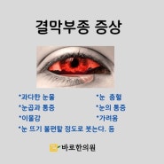 광명 비강사혈한의원 결막부종 원인 치료