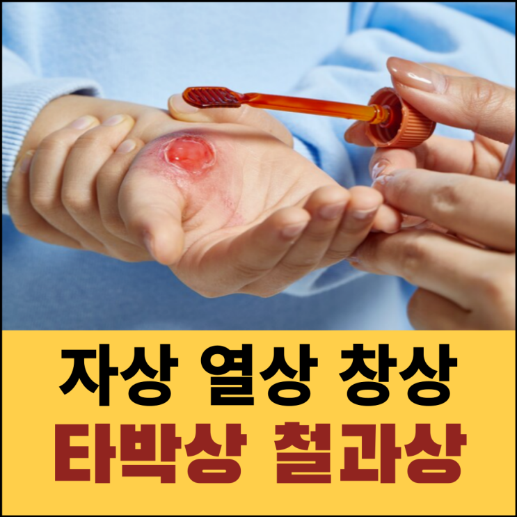 자상 열상 차이점 뜻 창상 타박상 찰과상 응급처치 방법 : 네이버 블로그