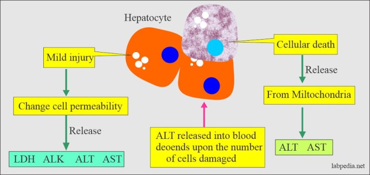 간수치 ALT, AST 상승의 원인과 임상적 해석(Understanding the factors of elevated ALT ...